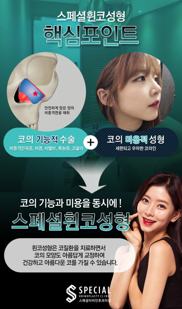 휜코성형_포인트